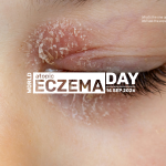 World Atopic Eczema Day 2026